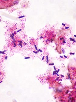 StatLab HCS Control Slides Gram 2 Tissue Slides