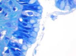 StatLab HCS Control Slides H-Pylori Non-Adhesion