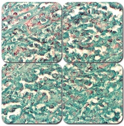 StatLab&nbsp;MasterTech AFB Stain Kit