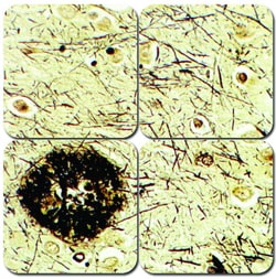 StatLab MasterTech Modified Bielschowsky's Stain Kit 100 mL | Buy Online | StatLab | Fisher Scientific