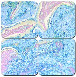 StatLab MasterTech Colloidal Iron Stain Kit Colloidal Iron | Buy Online | StatLab | Fisher Scientific