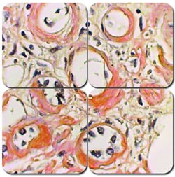 StatLab&nbsp;MasterTech Congo Red Amyloid Stain Kit