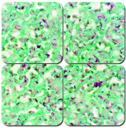 StatLab&nbsp;MasterTech Fite's Stain Kit, Modified - Leprosy Stain