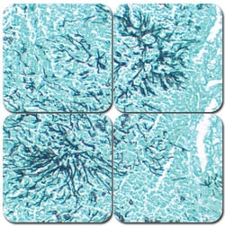 StatLab&nbsp;MasterTech GMS Stain Kit