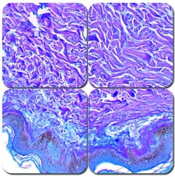 StatLab&nbsp;MasterTech Herovici's Collagen Stain Kit