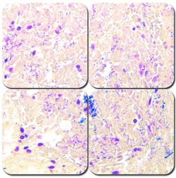 StatLab&nbsp;MasterTech McDonald's Gram Stain Kit