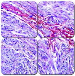 StatLab&nbsp;MasterTech PTAH Stain Kit - Microwave