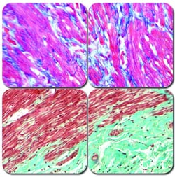 StatLab&nbsp;MasterTech Trichrome Stain Kit - One-Step Blue and Red