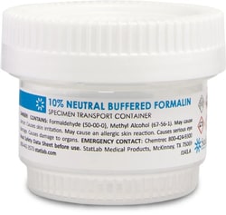 StatLab&nbsp;Custom Pre-fill Buffered Formalin for SEP