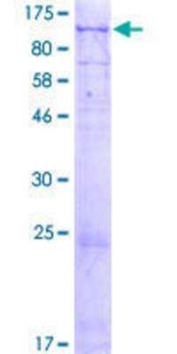 Novus Biologicals Recombinant Human RADX GST (N-Term) Protein 2 &mu;g | Buy Online | Novus Biologicals&trade; | Fisher Scientific