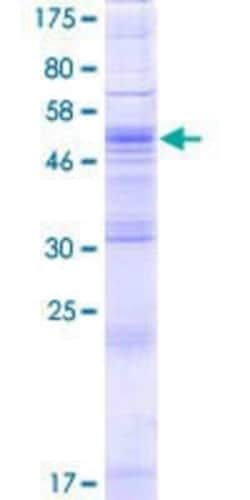 Novus Biologicals Recombinant Human ZDHHC4 GST (N-Term) Protein 2 &mu;g | Buy Online | Novus Biologicals&trade; | Fisher Scientific
