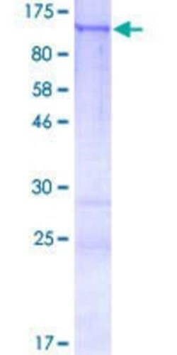 Novus Biologicals Recombinant Human CCDC87 GST (N-Term) Protein 2 &mu;g | Buy Online | Novus Biologicals&trade; | Fisher Scientific