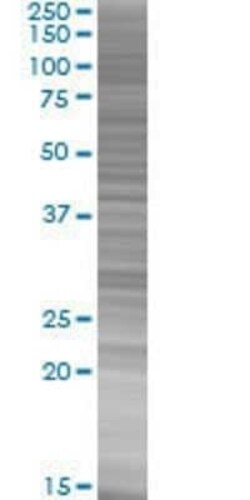 Novus Biologicals ZNF444 293T Cell Transient Overexpression Lysate 0.1 mL | Buy Online | Novus Biologicals&trade; | Fisher Scientific