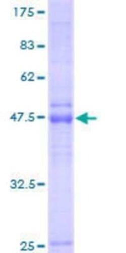 Novus Biologicals Recombinant Human LAPTM4B GST (N-Term) Protein 2 &mu;g | Buy Online | Novus Biologicals&trade; | Fisher Scientific