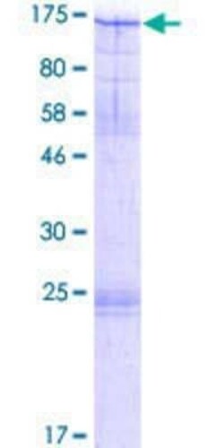 Novus Biologicals Recombinant Human MCM10 GST (N-Term) Protein 2 &mu;g | Buy Online | Novus Biologicals&trade; | Fisher Scientific