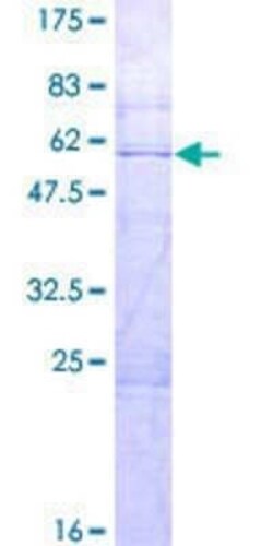Novus Biologicals Recombinant Human RNPC1 GST (N-Term) Protein 2 &mu;g | Buy Online | Novus Biologicals&trade; | Fisher Scientific