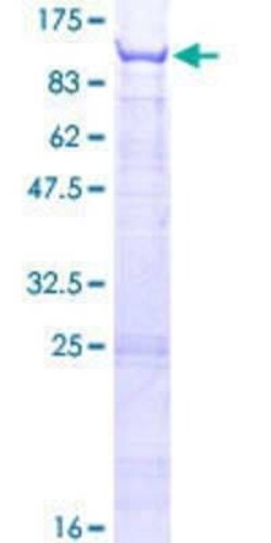Novus Biologicals Recombinant Human TRM1 GST (N-Term) Protein 2 &mu;g | Buy Online | Novus Biologicals&trade; | Fisher Scientific