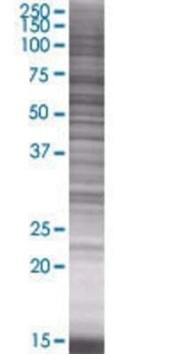 Novus Biologicals TBC1D22B 293T Cell Transient Overexpression Lysate 0.1 mL | Buy Online | Novus Biologicals&trade; | Fisher Scientific