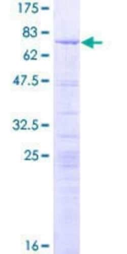 Novus Biologicals Recombinant Human LYAR GST (N-Term) Protein 2 &mu;g | Buy Online | Novus Biologicals&trade; | Fisher Scientific