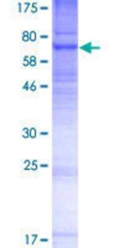 Novus Biologicals Recombinant Human PIGV GST (N-Term) Protein 2 &mu;g | Buy Online | Novus Biologicals&trade; | Fisher Scientific