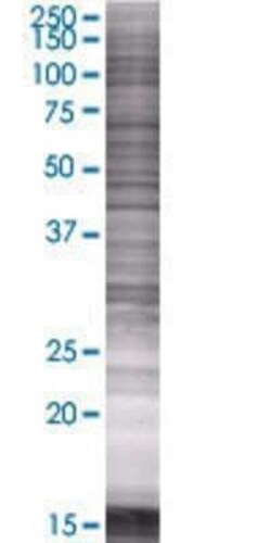Novus Biologicals ARHGEF40 293T Cell Transient Overexpression Lysate 0.1 mL | Buy Online | Novus Biologicals&trade; | Fisher Scientific