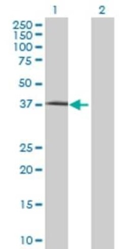 Novus Biologicals ARHGEF40 293T Cell Transient Overexpression Lysate 0.1 mL | Buy Online | Novus Biologicals&trade; | Fisher Scientific