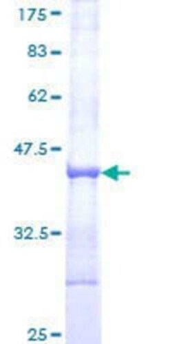 Novus Biologicals Recombinant Human RNF130 GST (N-Term) Protein 2 &mu;g | Buy Online | Novus Biologicals&trade; | Fisher Scientific
