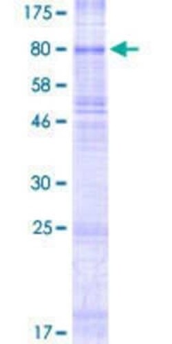 Novus Biologicals Recombinant Human SLC22A11 GST (N-Term) Protein 2 &mu;g | Buy Online | Novus Biologicals&trade; | Fisher Scientific
