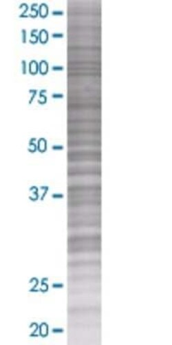 Novus Biologicals ZNF167 293T Cell Transient Overexpression Lysate 0.1 mL | Buy Online | Novus Biologicals&trade; | Fisher Scientific