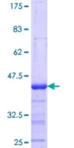 Novus Biologicals Recombinant Human NXF3 GST (N-Term) Protein 2 &mu;g | Buy Online | Novus Biologicals&trade; | Fisher Scientific