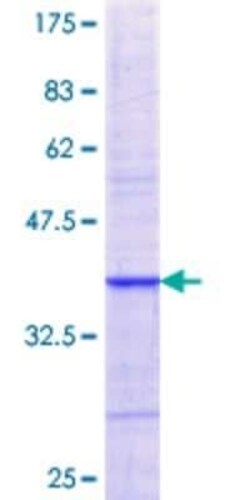 Novus Biologicals Recombinant Human NXF2 GST (N-Term) Protein 2 &mu;g | Buy Online | Novus Biologicals&trade; | Fisher Scientific