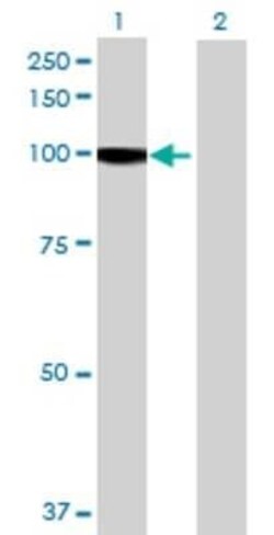 Novus Biologicals PCDHGA11 293T Cell Transient Overexpression Lysate 0.1 mL | Buy Online | Novus Biologicals&trade; | Fisher Scientific