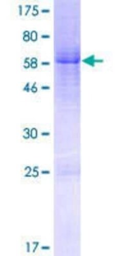 Novus Biologicals Recombinant Human FAM54B GST (N-Term) Protein 2 &mu;g | Buy Online | Novus Biologicals&trade; | Fisher Scientific