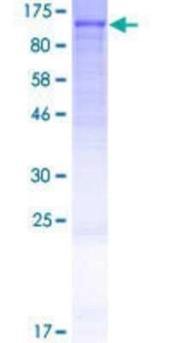 Novus Biologicals Recombinant Human FAM214A GST (N-Term) Protein 2 &mu;g | Buy Online | Novus Biologicals&trade; | Fisher Scientific