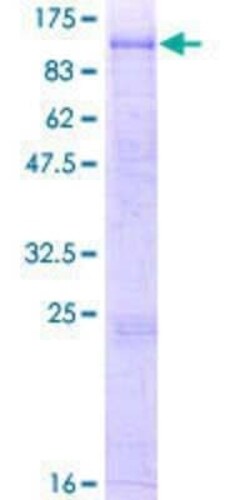 Novus Biologicals Recombinant Human Carboxypeptidase X1/CPXM1 GST (N-Term) Protein 2 &mu;g | Buy Online | Novus Biologicals&trade; | Fisher Scientific