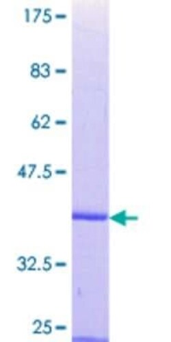 Novus Biologicals Recombinant Human PARD3/Par3 GST (N-Term) Protein 2 &mu;g | Buy Online | Novus Biologicals&trade; | Fisher Scientific