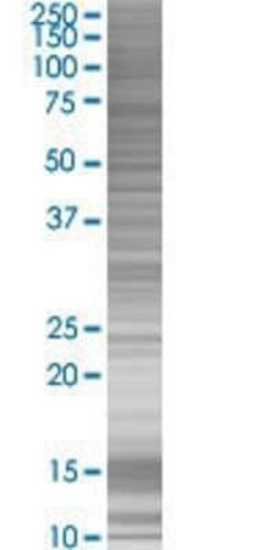 Novus Biologicals PARD3/Par3 293T Cell Transient Overexpression Lysate 0.1 mL | Buy Online | Novus Biologicals&trade; | Fisher Scientific