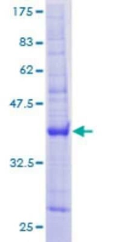 Novus Biologicals Recombinant Human TMEM9B GST (N-Term) Protein 2 &mu;g | Buy Online | Novus Biologicals&trade; | Fisher Scientific
