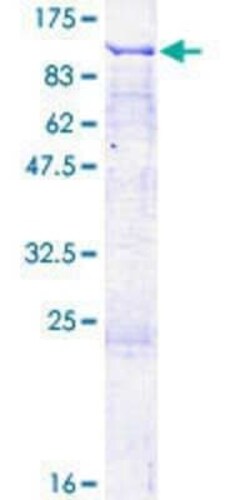 Novus Biologicals Recombinant Human ZCCHV GST (N-Term) Protein 2 &mu;g | Buy Online | Novus Biologicals&trade; | Fisher Scientific