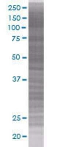 Novus Biologicals IFN-kappa 293T Cell Transient Overexpression Lysate 0.1 mL | Buy Online | Novus Biologicals&trade; | Fisher Scientific