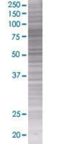 Novus Biologicals Sphingosine Kinase 2/SPHK2 293T Cell Transient Overexpression Lysate 0.1 mL | Buy Online | Novus Biologicals&trade; | Fisher Scientific