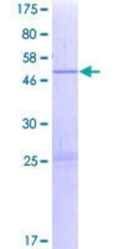 Novus Biologicals Recombinant Human EMC7 GST (N-Term) Protein 2 &mu;g | Buy Online | Novus Biologicals&trade; | Fisher Scientific