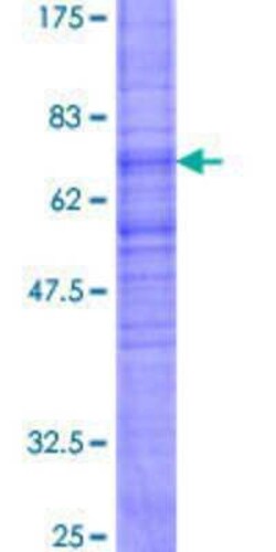 Novus Biologicals Recombinant Human Neuromedin UR2/NMUR2 GST (N-Term) Protein 2 &mu;g | Buy Online | Novus Biologicals&trade; | Fisher Scientific