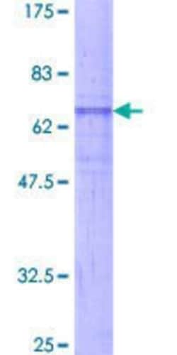 Novus Biologicals Recombinant Human Neuromedin UR2/NMUR2 GST (N-Term) Protein 2 &mu;g | Buy Online | Novus Biologicals&trade; | Fisher Scientific