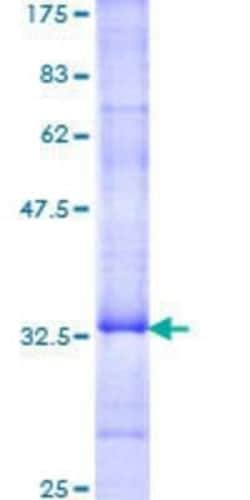 Novus Biologicals Recombinant Human Neuromedin UR2/NMUR2 GST (N-Term) Protein 25 &mu;g | Buy Online | Novus Biologicals&trade; | Fisher Scientific