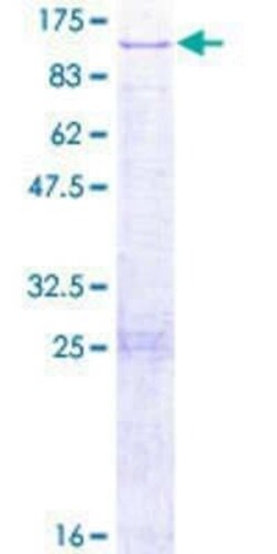 Novus Biologicals Recombinant Human DUS3L GST (N-Term) Protein 2 &mu;g | Buy Online | Novus Biologicals&trade; | Fisher Scientific