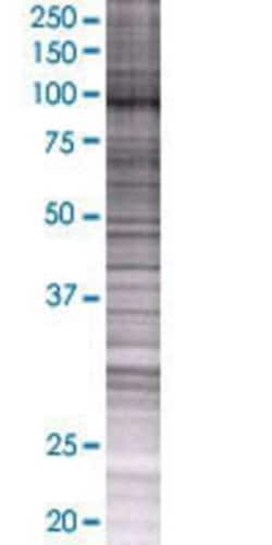 Novus Biologicals XAB2 293T Cell Transient Overexpression Lysate 0.1 mL | Buy Online | Novus Biologicals&trade; | Fisher Scientific