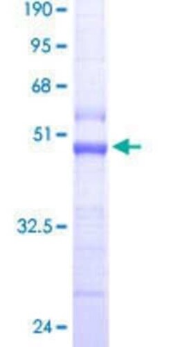 Novus Biologicals Recombinant Human TOMM22 GST (N-Term) Protein 10 &mu;g | Buy Online | Novus Biologicals&trade; | Fisher Scientific