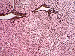 StatLab HCS Control Slides Reticulum Adhesion Slides