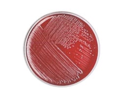Thermo Scientific™ Pasteurella Selective Agar